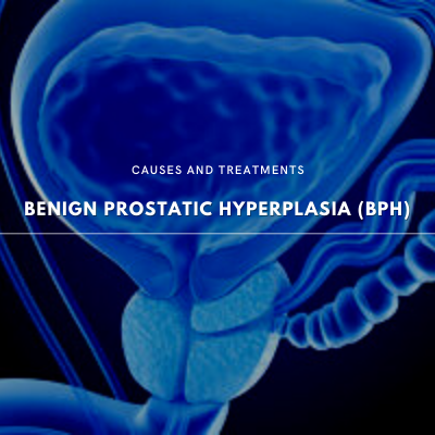BPH causes and treatments